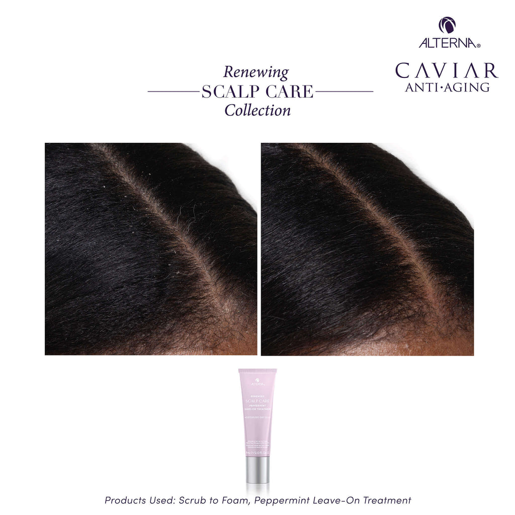 Alterna Renewing Scalp Care Peppermint Leave-On Treatment