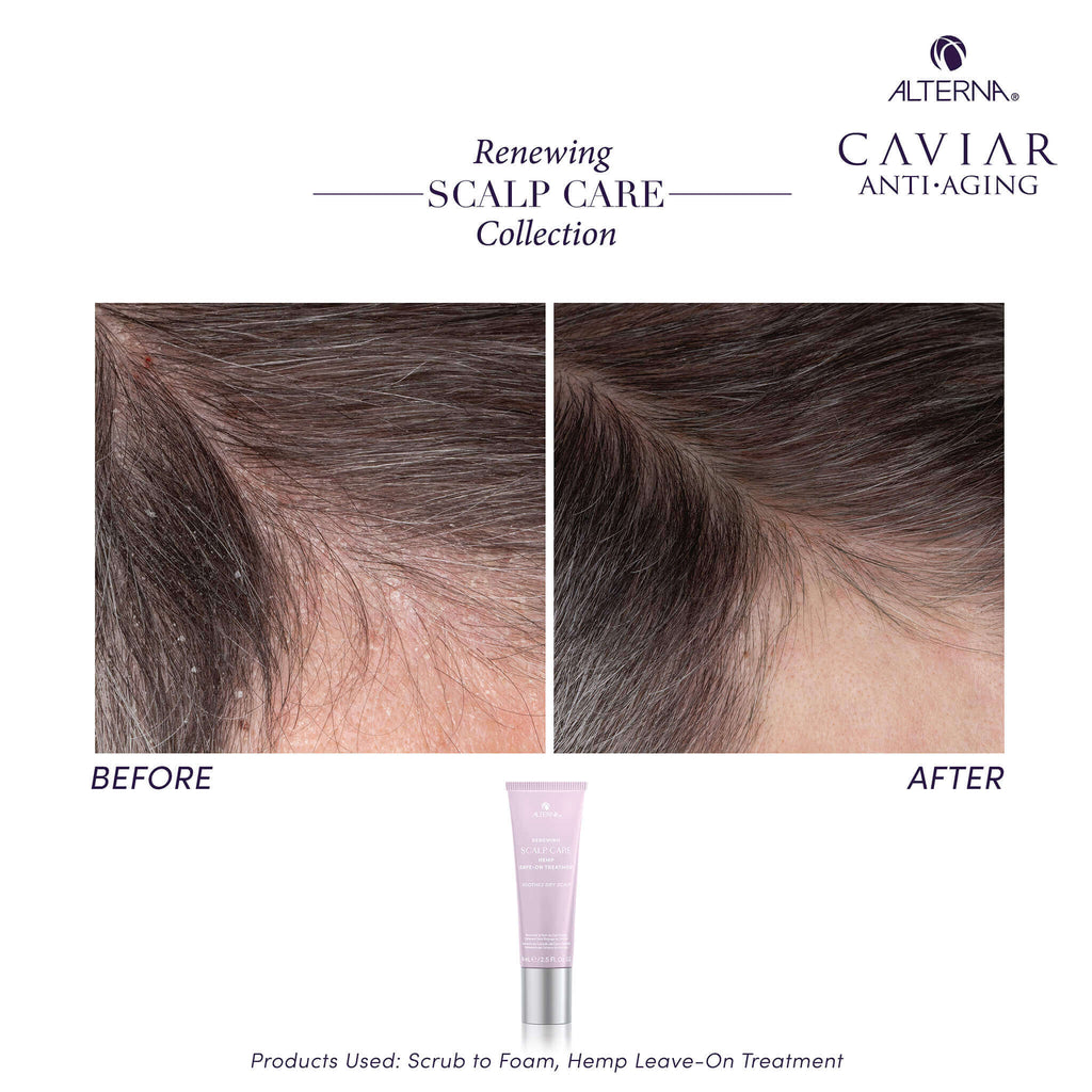Alterna Renewing Scalp Care Hemp Leave-On Treatment