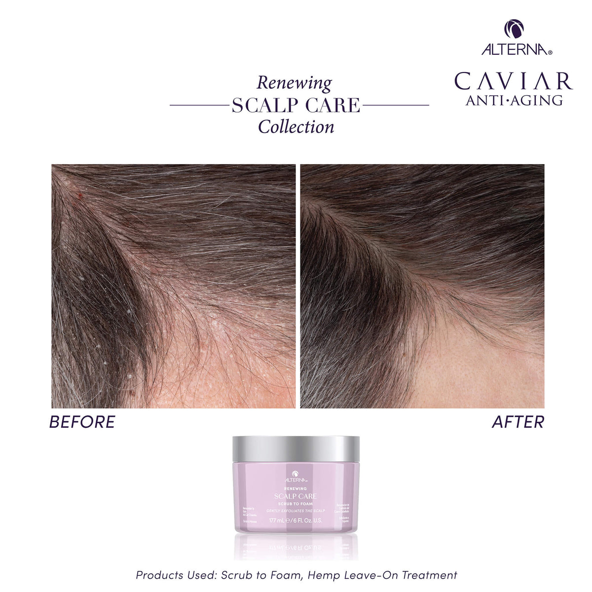 Alterna Renewing Scalp Care Scrub to Foam